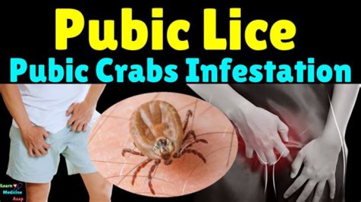 Are pubic lice going extinct?