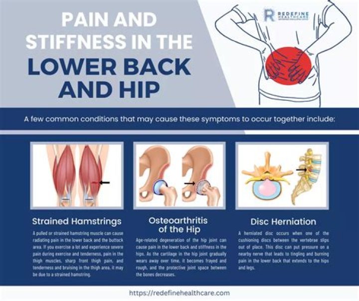 Can MS cause back and hip pain?