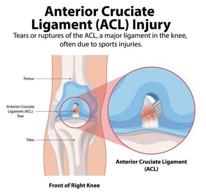 When is ACL graft most vulnerable?